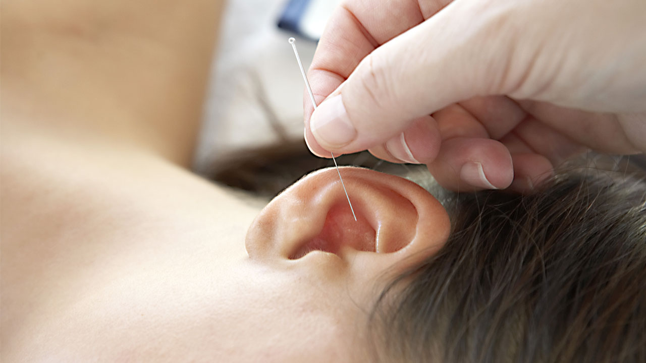 Ohr-Akupunktur Verfahren