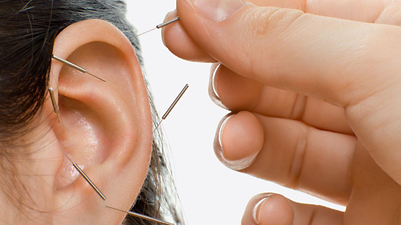 Ohr-Akupunktur Anwendung